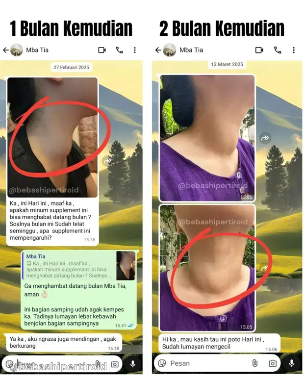 Perubahan pembengkakan leher Tia pada bulan pertama dan kedua