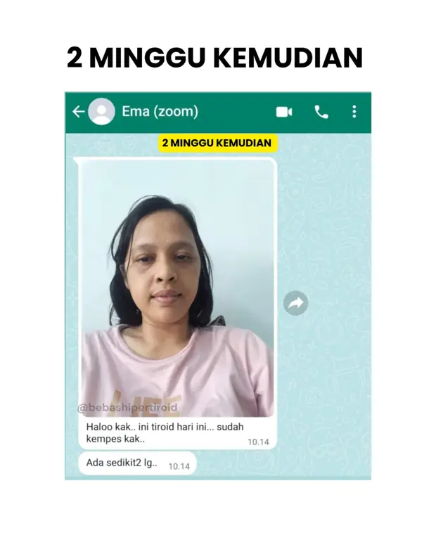 Perubahan kondisi Ema dua minggu kemudian